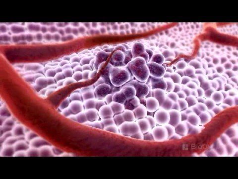 3D Health care Animation – What is Cancer?